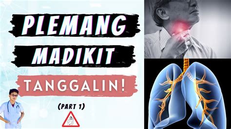 gamot sa plema na ayaw lumabas|Gamot sa Sipon na ayaw lumabas .